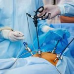 ByRL-LAPAROSCOPIC-SCISSORS