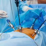 Suction-&-Irrigation-Set