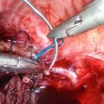 needle-holder-product